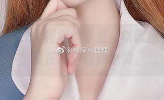 更新！神探火狸狸的可爱，以前还不觉得，现在特别想点个赞。